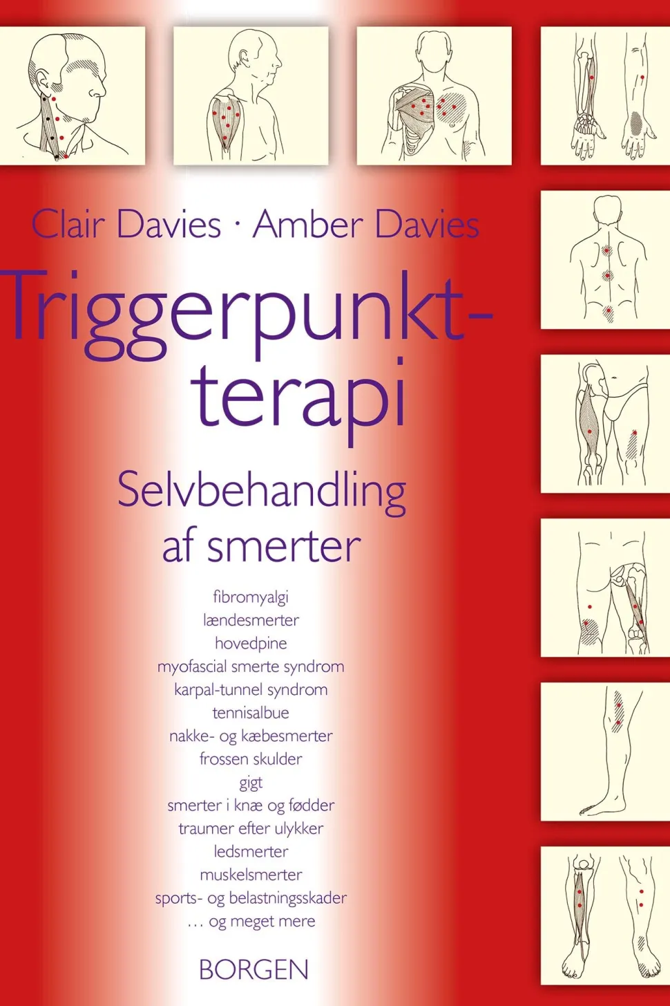 Triggerpunkt-terapi: Selvbehandling af smerter (Ebog, epub, Dansk) af Clair Davies